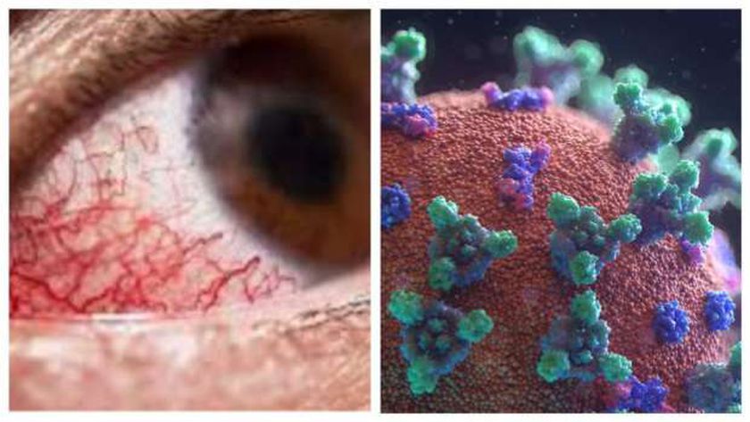 الفطر الأسود يظهر في مصر